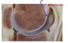 <p>what part of the joint does the red arrow point to</p>