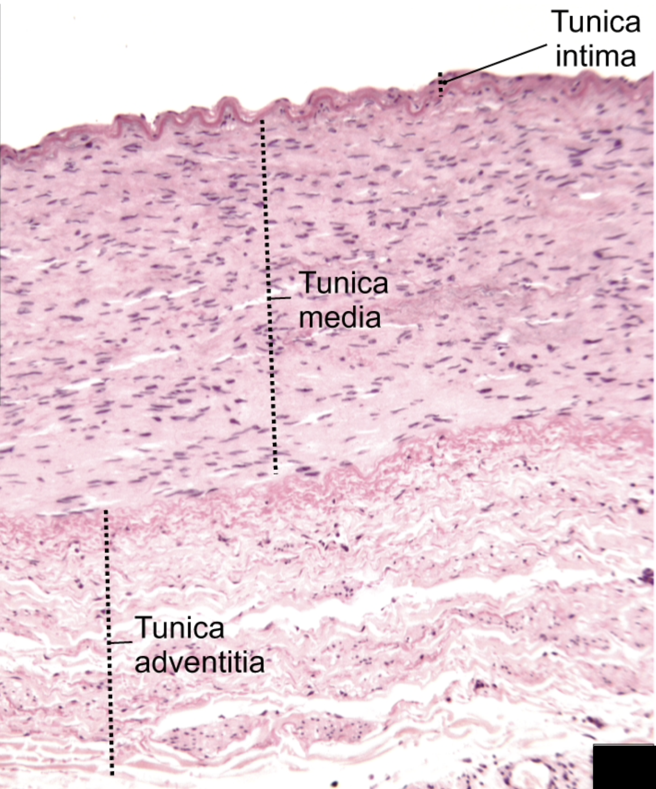 <p>medium artery</p>
