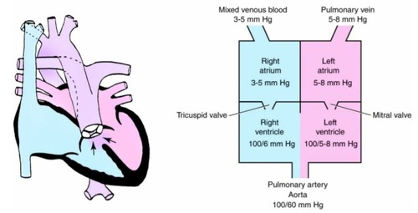 <p>a. truncus arteriosus</p><p>b. hypoplastic left ventricle</p><p>c. transposition of the great vessels</p><p>d. ventricular septal defect</p>