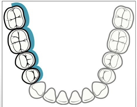 <p>What aspect is this?</p>