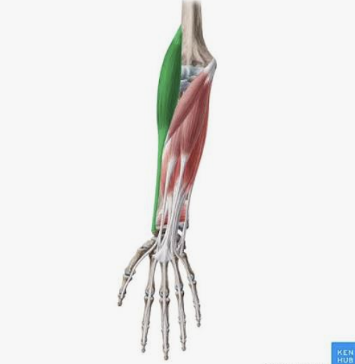<p>Which muscle is this?</p>