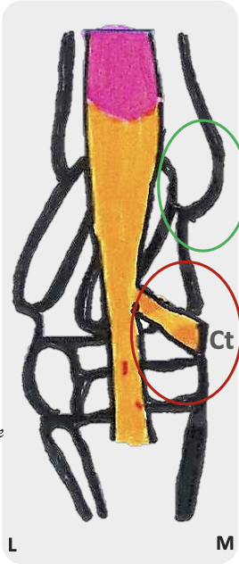 <p>Cunean tendon </p>
