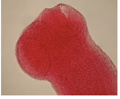 <p>What type of cestode is this?</p>