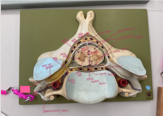 <p>What is being shown </p>