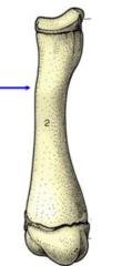 <p>classification of a long bone</p><p>Epiphysis</p><p>Diaphysis</p><p>Epiphysis </p>