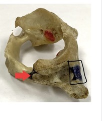 <p>what is marked? (not the arrow)</p>