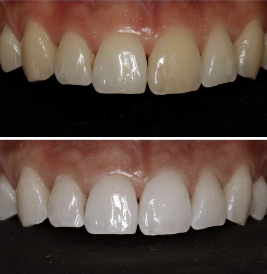 <p>What dental specialty is being displayed here?</p>