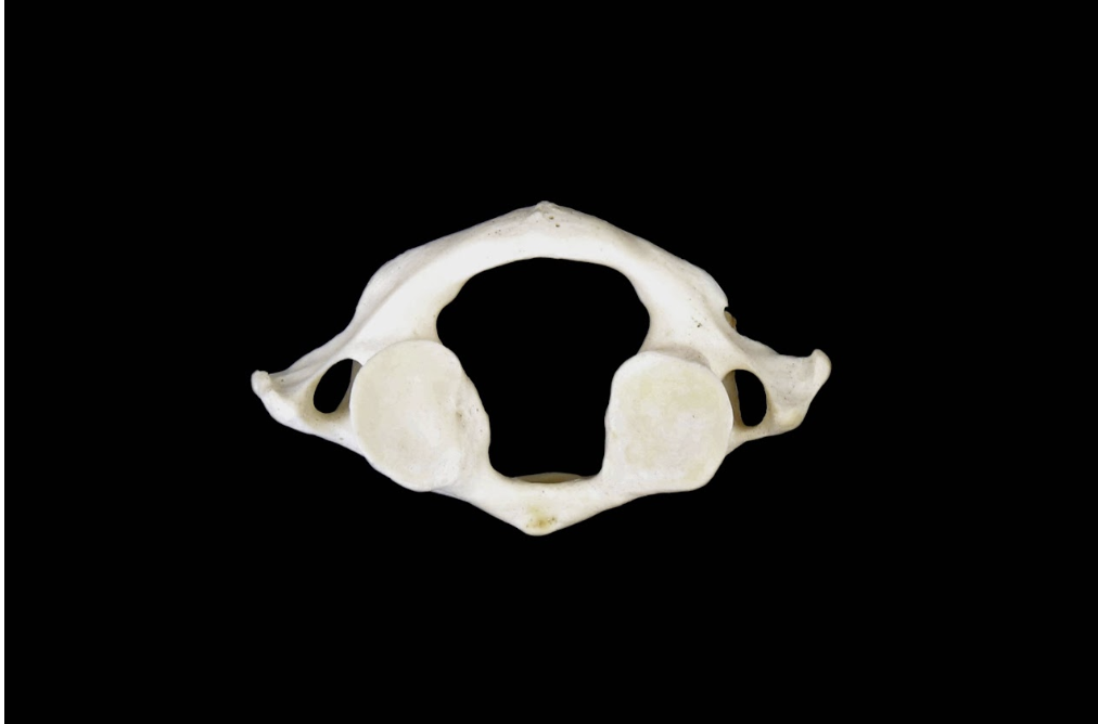 <p>Identify the vertebrae </p>