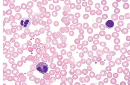 <p>what tissue is this</p>