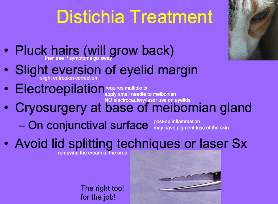 <p>Pluck hair.</p><p>Slight eversion of eyelid margin (done if there are multiple).</p><p>Electroepilation.Í</p><p>Cryosurgery at base of meibomian gland, on conjunctival surface.</p>