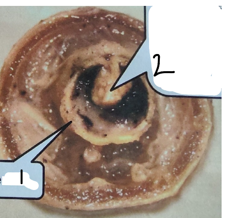 <p>What is point 1 on this earthworm</p>