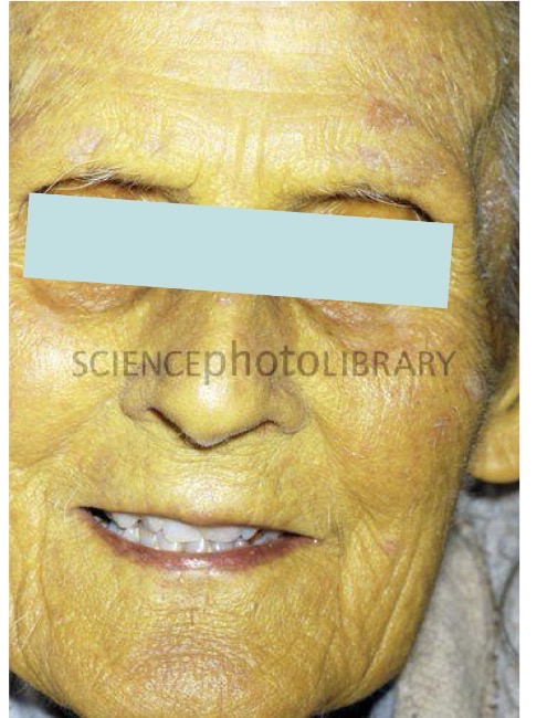 term image
