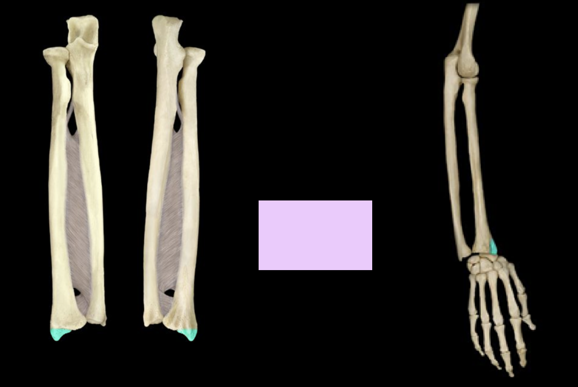 <p>What is the highlighted structure?</p>