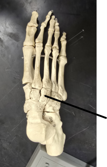 <p>Name Tarsal Bone</p>