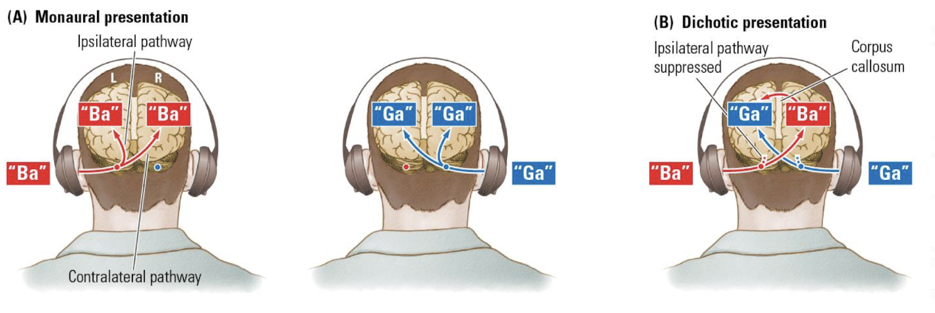 Kimura's Dichotic Listening Model
