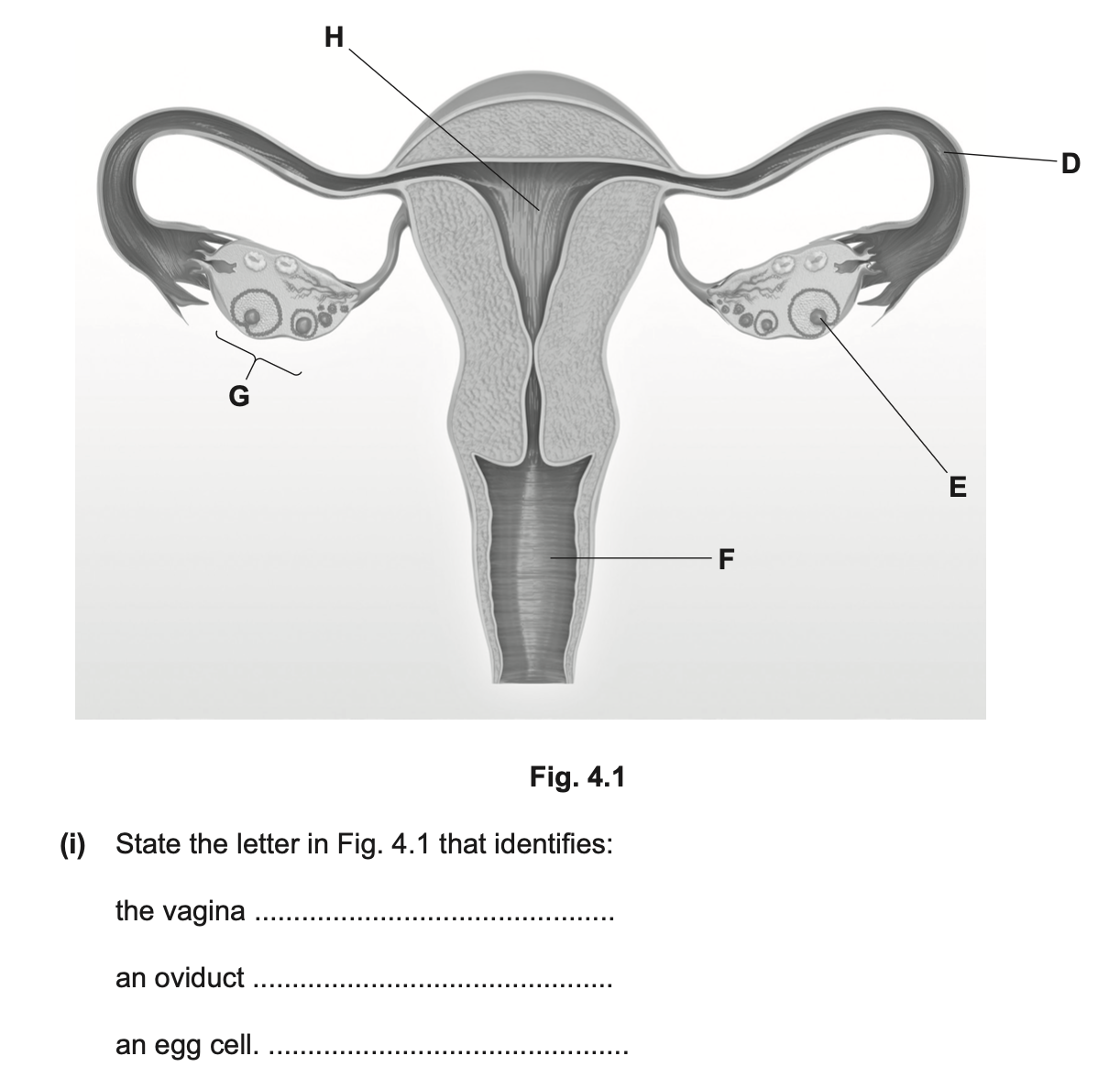 <p>State the letter</p>