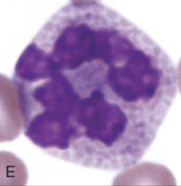 <p><span>Which type of white blood cell is shown in this picture? What are the characteristics of this type of white blood cell?</span></p>