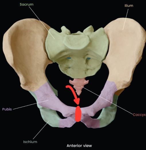 term image
