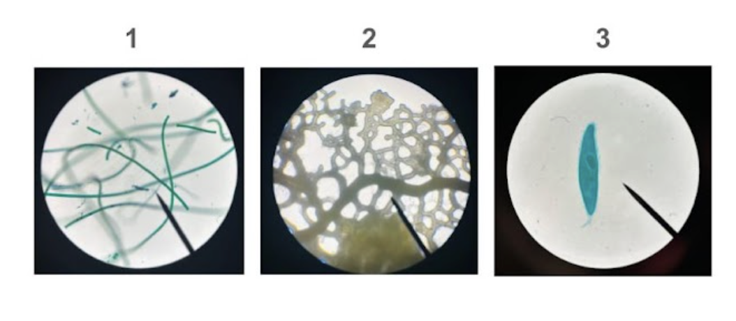 <p><span style="line-height: 1.5;">23. Observe the micrographs below. Which of the following correctly identifies the bacteria, protists, and eukaryotes?<br>A. 1 = Eukaryote, 2 = Prokaryote, 3 = Protist</span></p><p><span style="line-height: 1.5;">B. 1 = Eukaryote, 2 = Protist, 3 = Prokaryote</span> </p><p><span style="line-height: 1.5;">C. 1 = Prokaryote, 2 = Eukaryote, 3 = Protist</span></p><p><span style="line-height: 1.5;">D. 1 = Prokaryote, 2 = Prokaryote, 3 = Protist</span></p>