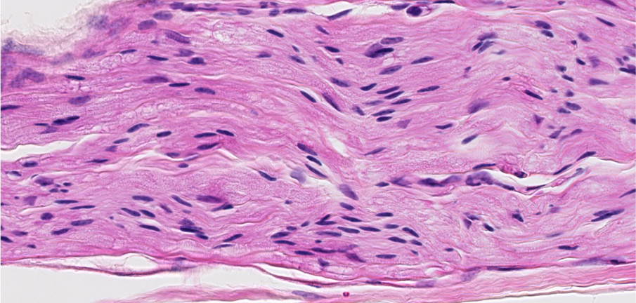 <p><span style="font-family: "Calibri Light";">Is this nerve fascicle myelinated or unmyelinated?</span></p>
