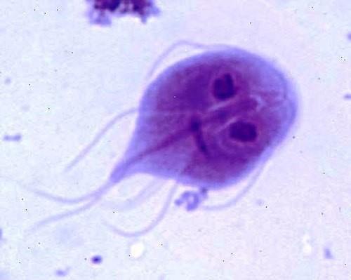 <p>Giardia intestinalis</p>