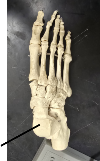 <p>Name Tarsal Bone</p>