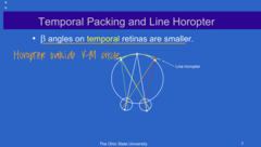 <p>When there is temporal packing, the ____ angles on the temporal retina is smaller</p>