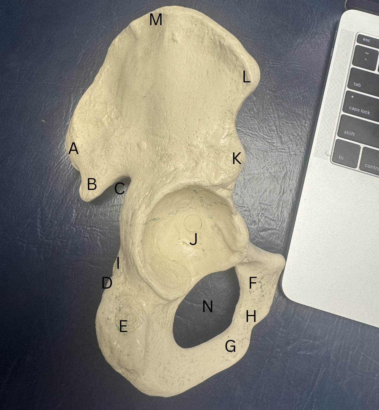 <p>Label these structures from the Innominate bone</p>