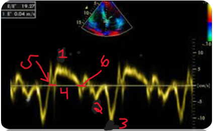 <p>What is located at 1? </p>
