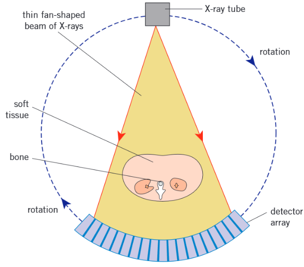 <ul><li><p>The X-ray tube rotates around patient, firing thin fan-shaped beams through patient. </p></li><li><p>Each full rotation produces an image of a cross-section of the patient (a slice)</p></li><li><p>The patient slowly moves through ring as it rotates, so each rotation produces an image of a new slice</p></li><li><p>A computer combines the 2D slices to give a detailed 3D image of the patient in which soft tissues can be identified.</p></li></ul><p></p>