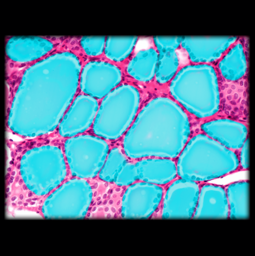 <p>Thyroid Follicle</p>