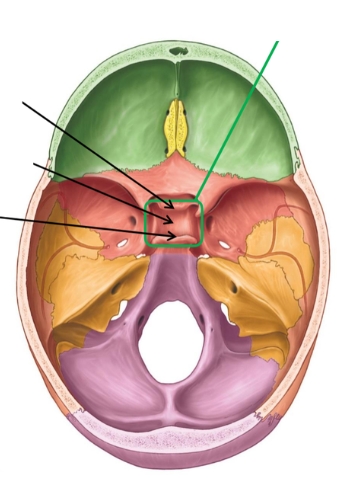 <p>Identify this bone feature labeled by green box and arrows and define its anatomical purpose.</p>