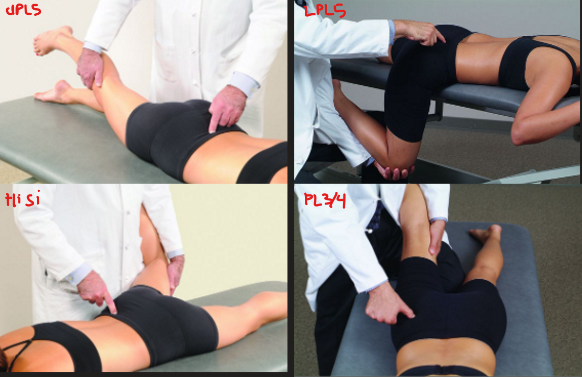 <ul><li><p><u>UPL5 </u>(sup. PSIS) →<strong> E Add er/ir</strong></p></li><li><p><u>high ilium sacroiliac </u>(lat. PSIS, press med.) → <strong>E Abd ER </strong></p></li><li><p><u>LPL5</u> (inf. PSIS, press sup.) → <strong>F IR Add</strong></p></li><li><p>high ilium flare ou<u>t</u> (lat. ILA or coccyx) →<strong> E Add</strong></p></li><li><p><u>PL3/4 lat.</u> (gluteus medius @ PSIS, TFL) → <strong>E Abd er</strong></p><ul><li><p>3 → 2/3 lat. PSIS to TFL</p></li><li><p>4 → post. margin TFL</p></li></ul></li></ul><p></p>