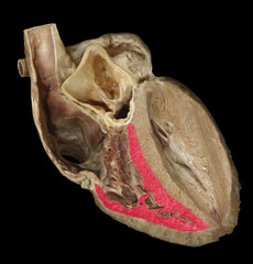 <p>identify the structure</p>