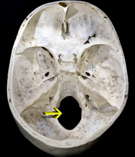 <p><span style="background-color: transparent;">The vertebral arteries enter the cranium at what location?</span></p>