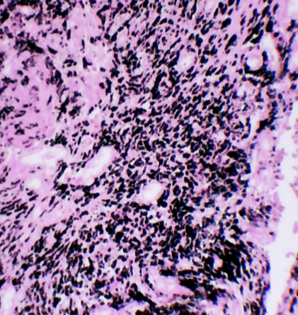 <p>ID this condition</p>