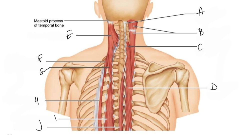 <p>longissimus cervicis</p>