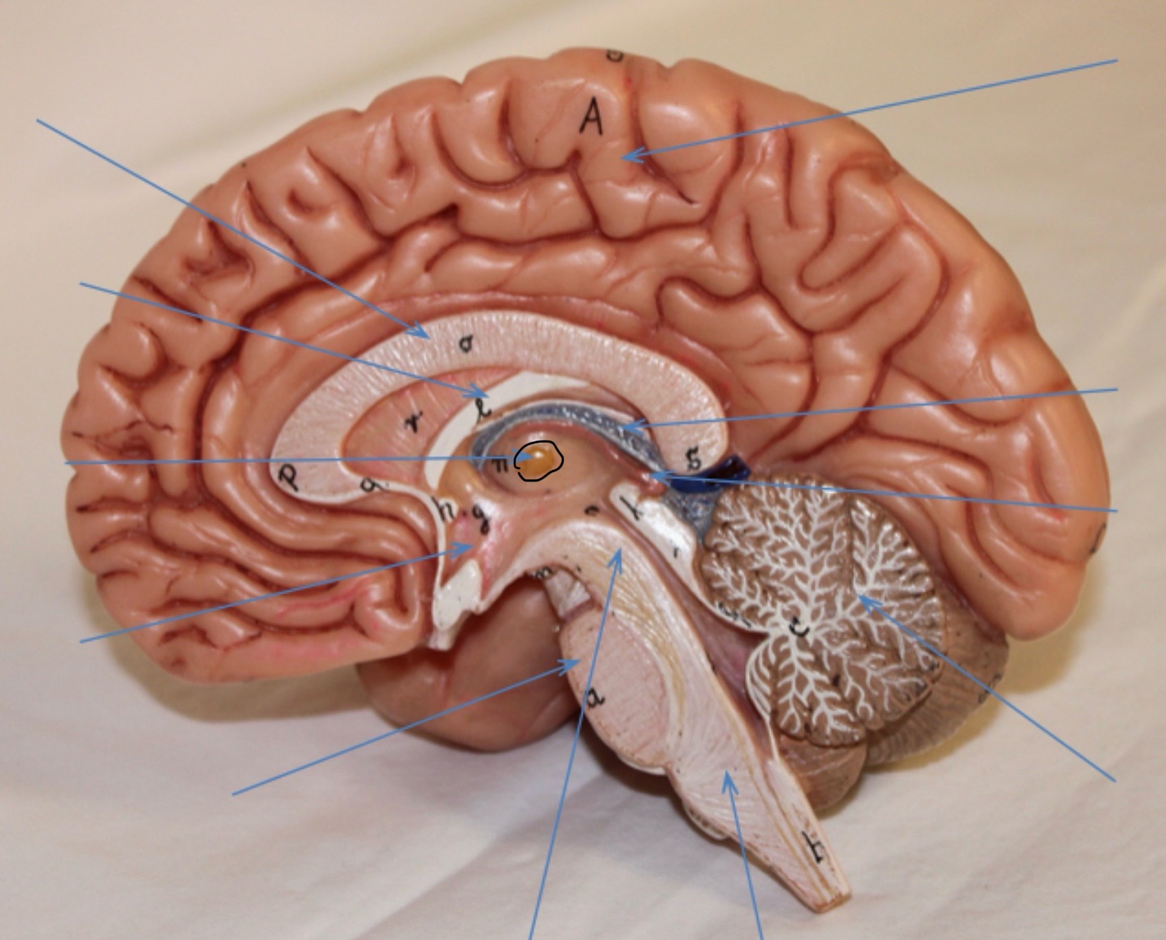 <p>Identify the circled area?</p>