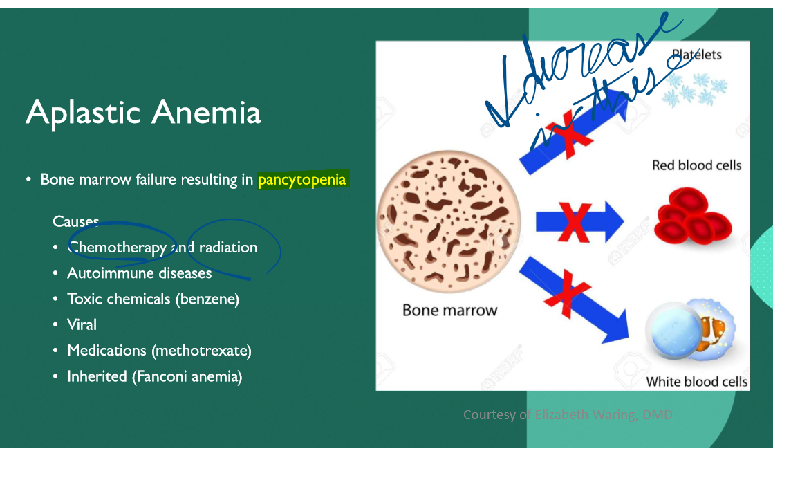 <p>Pancytopenia </p>