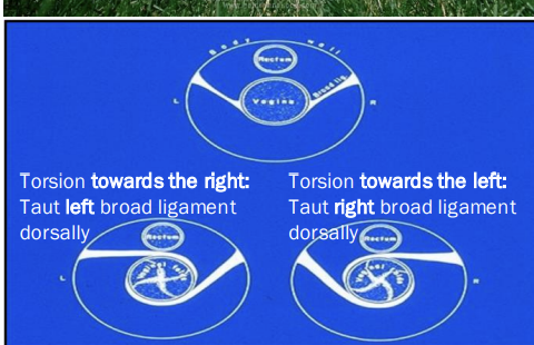 <p>common: mid to late gestation</p><p>risk factor: posture when cows get up, lack exercise, poor uterine tone, sliping/falling</p><p>signs: depends on degree of torsion, colic, fetal hypoxia and uterine necrosis</p><p></p>