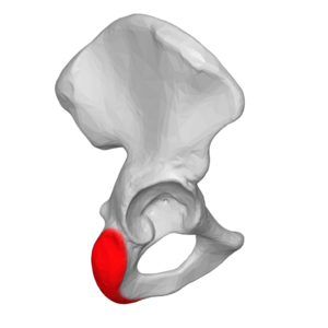 <p>What is the red?</p>