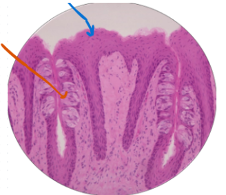 <p>What is this Histology slide? What is the blue arrow? What is the orange arrow?</p>
