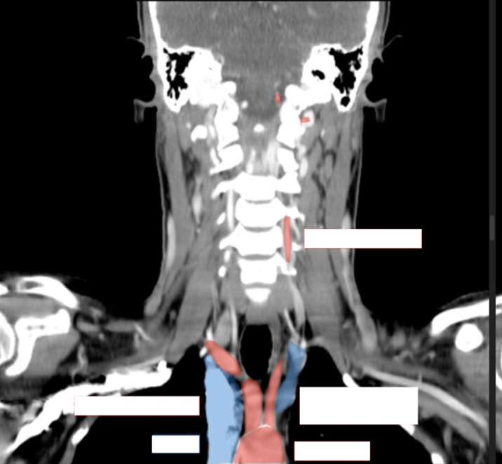 <p>Please label the following arteries </p>