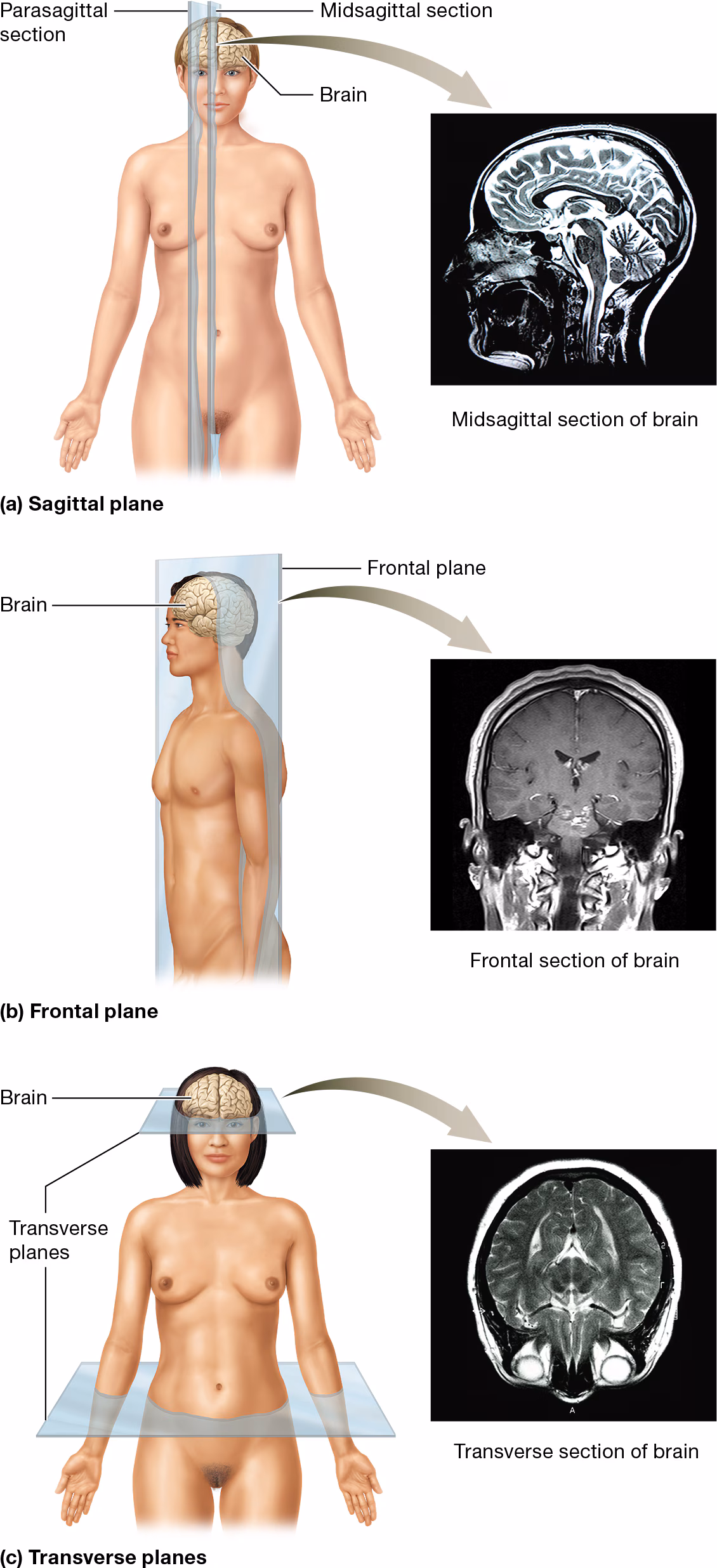 <p>Standard ways of dividing a body or body part to examine its internal structure.</p><ul><li><p>Note: Plane of section are not the same as directional terms</p></li></ul><p></p>