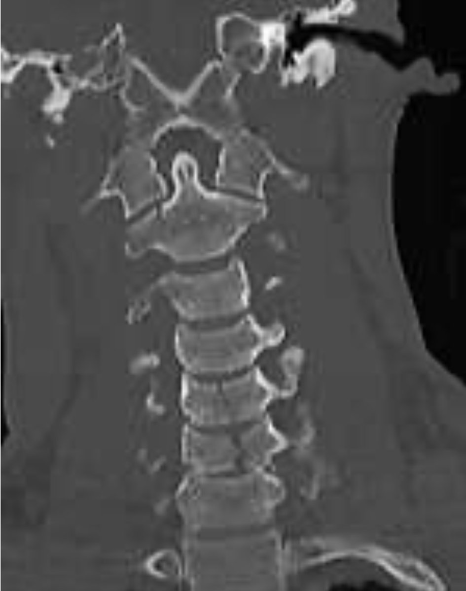 <p>What is the diagnosis?</p>