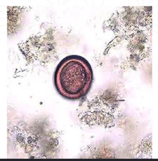 <p>Intermediate host is ruminant</p><p>This is _____</p>