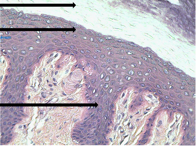 <p>Identify the following layers of the epidermis</p>