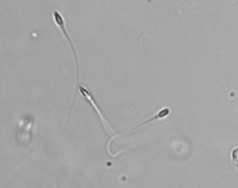 <p>Sperm</p>