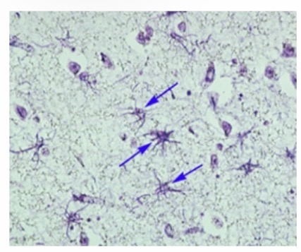<p>Astrocyte: Function: <span>Support neurons, maintain the blood-brain barrier, regulate chemicals, and help repair the CNS.</span></p>