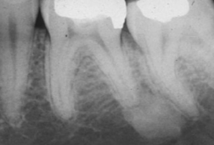 <p>how would you describe this radiographic lesion?</p>